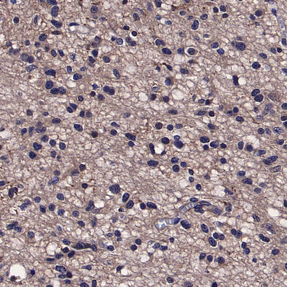 TREM2 Recombinant Rabbit mAb (S-5570)