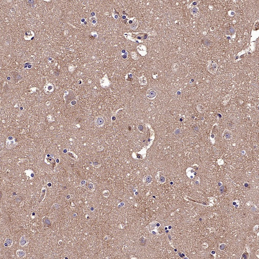 CALHM2 Recombinant Rabbit mAb (S-2671-146)