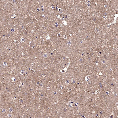 CALHM2 Recombinant Rabbit mAb (S-2671-146)