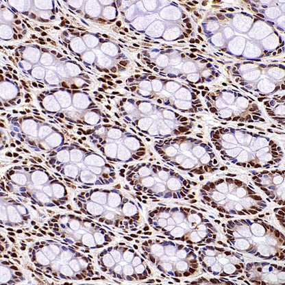 HuR/ELAVL1 Recombinant Rabbit mAb (S-2357-20)