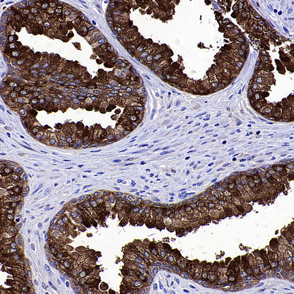 MSMB Recombinant Rabbit mAb (S-3400-1)