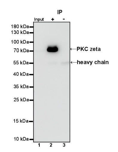 PKC zeta Recombinant Rabbit mAb (S-1306-34)