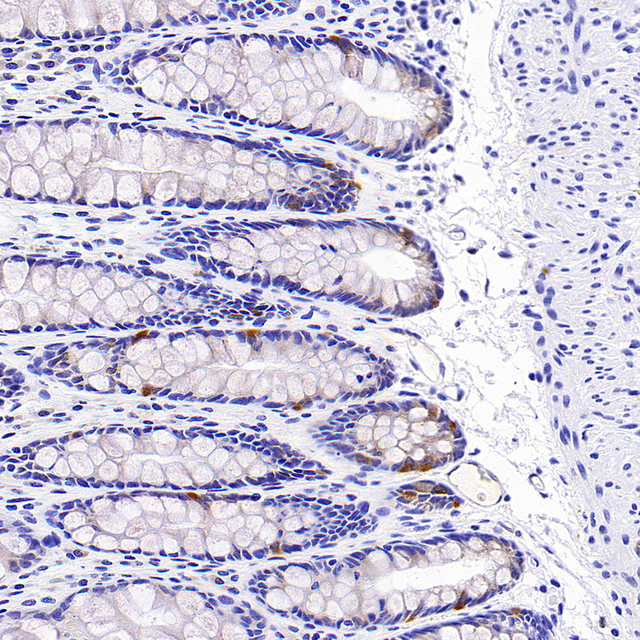 Rab3D Recombinant Rabbit mAb (S-4406-22)