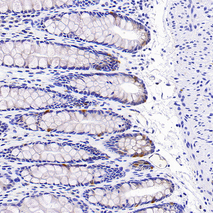 Rab3D Recombinant Rabbit mAb (S-4406-22)