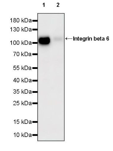Integrin beta 6 Recombinant Rabbit mAb (SDT-1445-78)