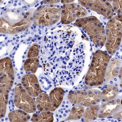 NGAL Recombinant Rabbit mAb (S-473-22)