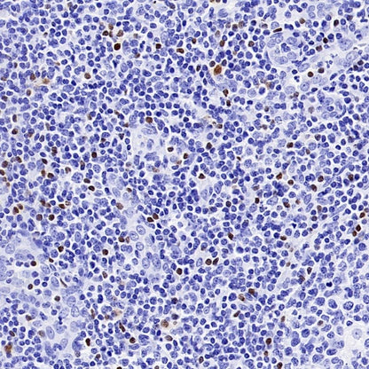 TBR2/Eomes Recombinant Rabbit mAb (SDT-1101-231)