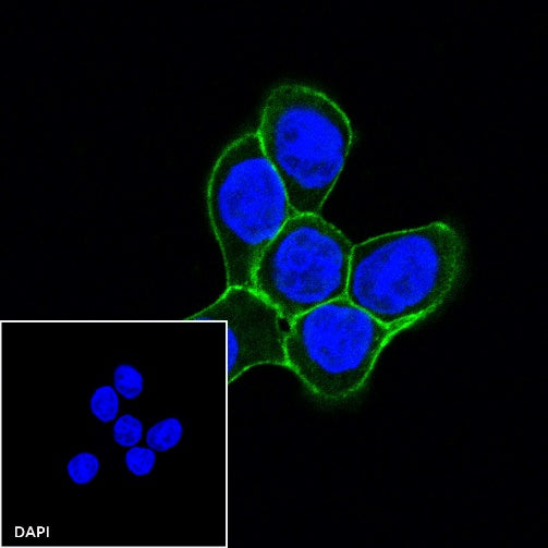E-Cadherin Recombinant Rabbit mAb (Alexa Fluor® 488 Conjugate) (S-438-5)