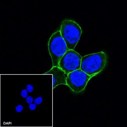 E-Cadherin Recombinant Rabbit mAb (Alexa Fluor® 488 Conjugate) (S-438-5)