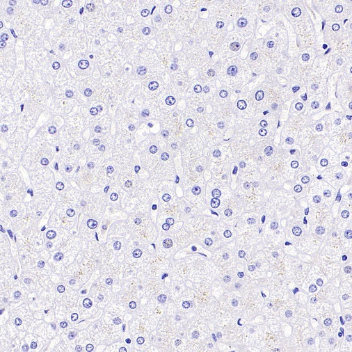 Islet1 Recombinant Rabbit mAb (SDT-2349-17)