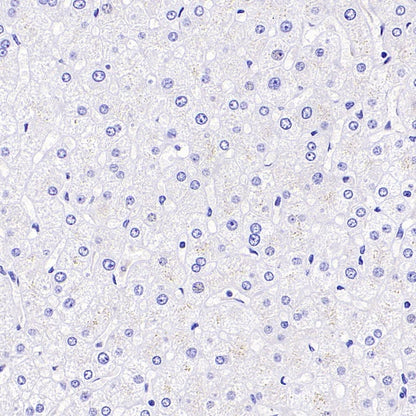 Islet1 Recombinant Rabbit mAb (SDT-2349-17)