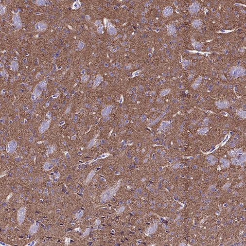 p35/25 Recombinant Rabbit mAb (S-2719-47)