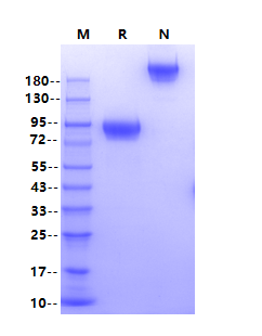 Biotinylated IL-2R gamma/CD132 Fc&Avi Tag Protein, Human