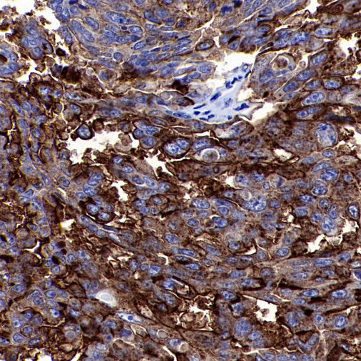 S-RMab® MUC1/EMA Recombinant Rabbit mAb (SDT-776-49)
