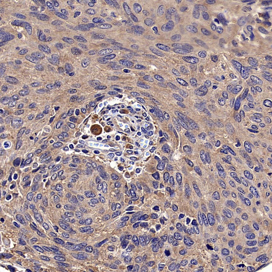 RPS14 Rabbit Polyclonal Antibody
