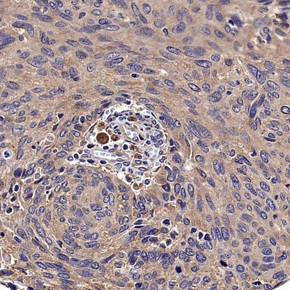 RPS14 Rabbit Polyclonal Antibody