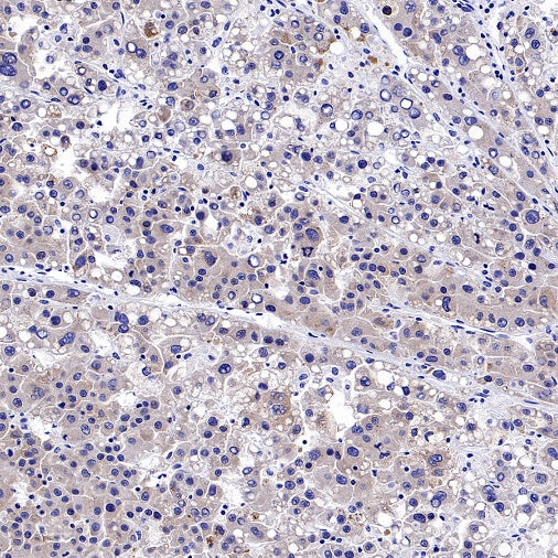 IGF2BP1 Recombinant Rabbit mAb (S-2947-19)