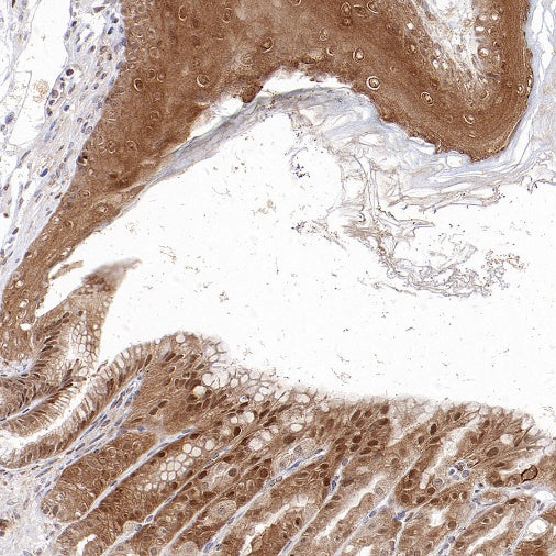 ASC/TMS1 Rabbit Polyclonal Antibody