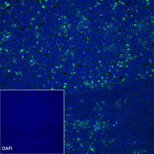 TIM-3 Recombinant Rabbit mAb (S-1450-21)