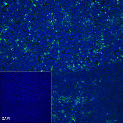TIM-3 Recombinant Rabbit mAb (S-1450-21)