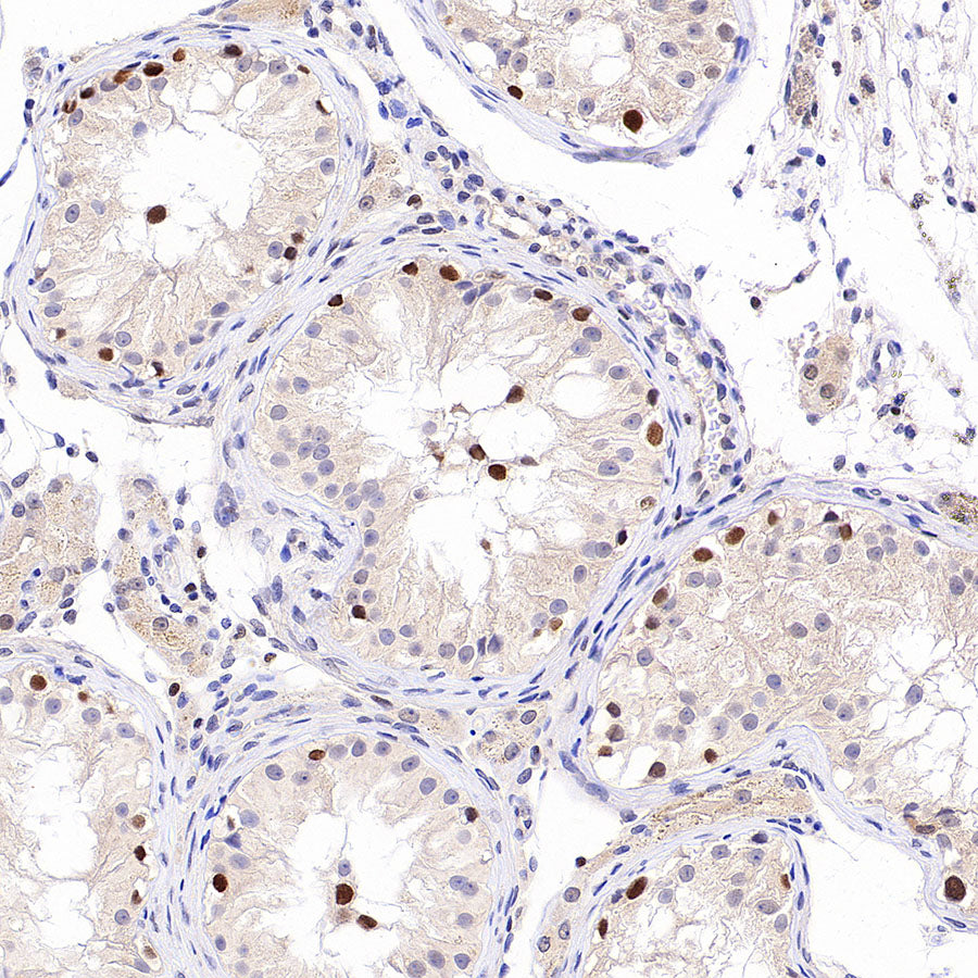 Chk2 Recombinant Rabbit mAb