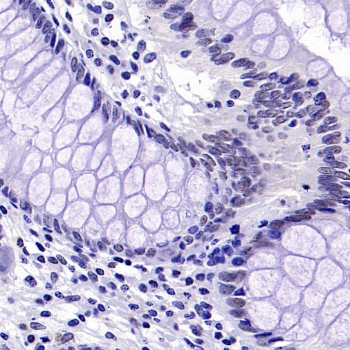 KDM4A Recombinant Rabbit mAb (S-957-138)