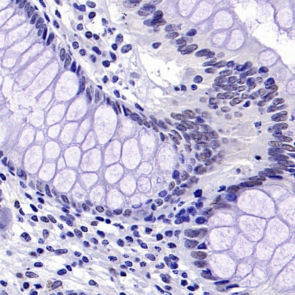 KDM4A Recombinant Rabbit mAb (S-957-138)
