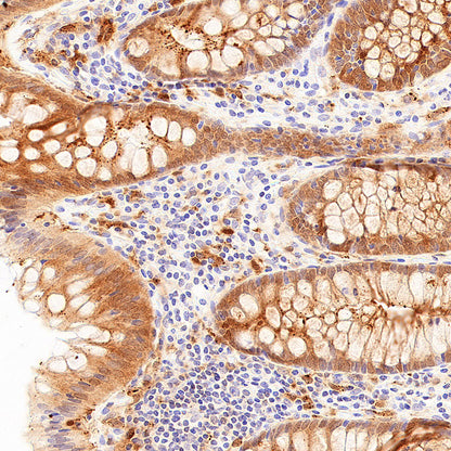 Galectin-9 Recombinant Rabbit mAb (S-4579-67)