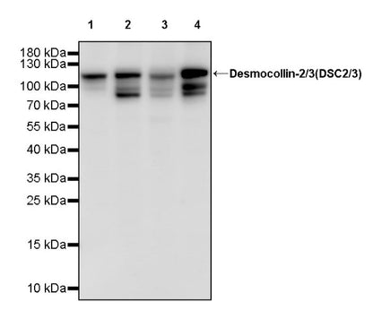 Desmocollin-2/3(DSC2/3) Recombinant Rabbit mAb (SDT-2102-59)