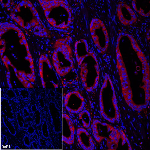 FASN Recombinant Rabbit mAb (PE Conjugate) (S-682-32)