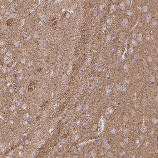 α/β-Tubulin Antibody Rabbit Polyclonal Antibody
