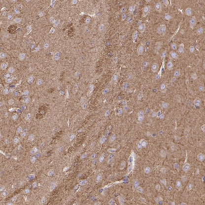 α/β-Tubulin Antibody Rabbit Polyclonal Antibody