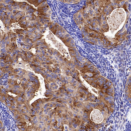 SORT1 Recombinant Rabbit mAb (S-2233-47)