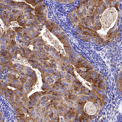 SORT1 Recombinant Rabbit mAb (S-2233-47)