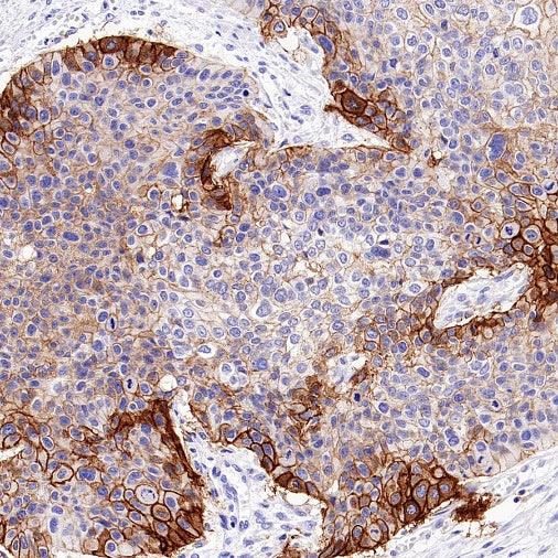 Integrin beta 6 Recombinant Rabbit mAb (SDT-1445-78)
