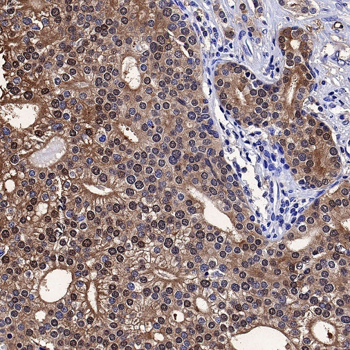 MIF Recombinant Rabbit mAb (S-1007-34)