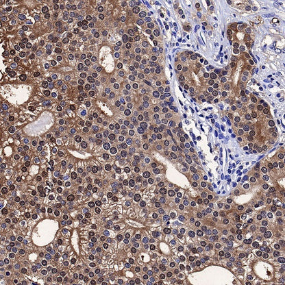 MIF Recombinant Rabbit mAb (S-1007-34)