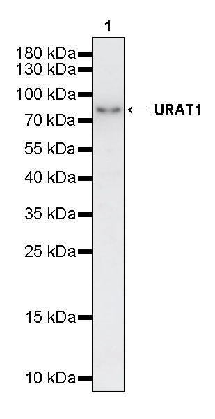 URAT1 Recombinant Rabbit mAb