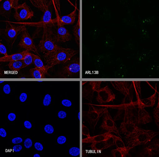 ARL13B Recombinant Rabbit mAb (S-2113-11)