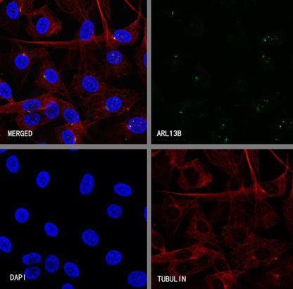 ARL13B Recombinant Rabbit mAb (S-2113-11)