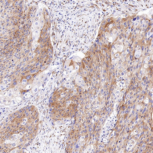 M6PR Recombinant Rabbit mAb (S-2348-14)