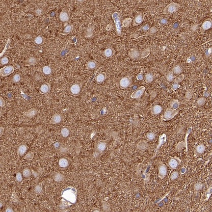 α-tubulin Recombinant Mouse mAb (S-364-23HL)
