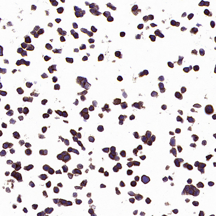 PTK7 Recombinant Rabbit mAb (SDT-2432-156)