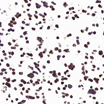 PTK7 Recombinant Rabbit mAb (SDT-2432-156)