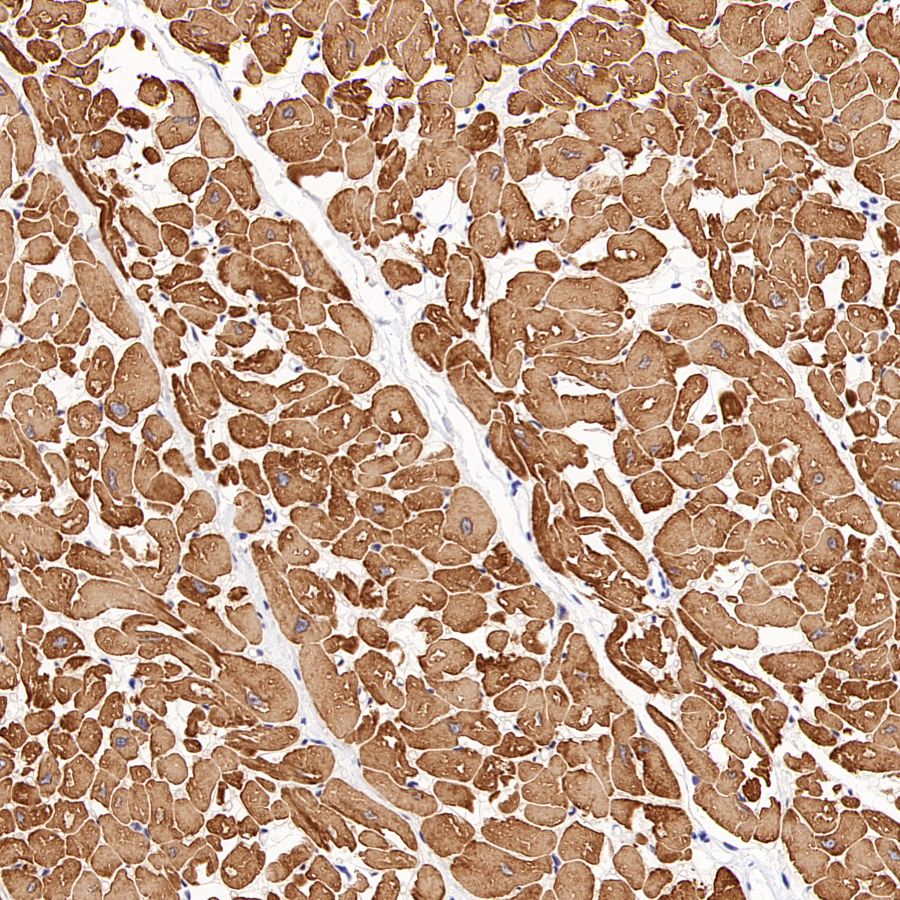Myosin Light Chain 2/MLC-2V Rabbit Polyclonal Antibody