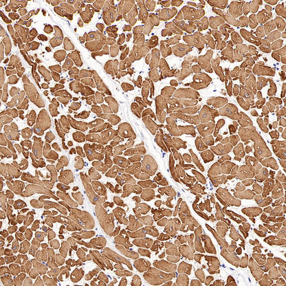 Myosin Light Chain 2/MLC-2V Rabbit Polyclonal Antibody