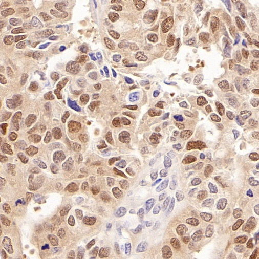Phospho-YAP (Ser127) Recombinant Rabbit mAb (S-4250)