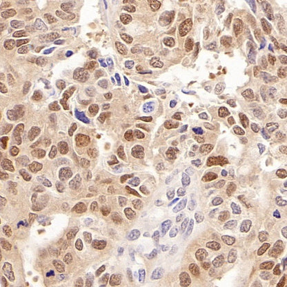 Phospho-YAP (Ser127) Recombinant Rabbit mAb (S-4250)