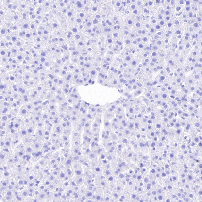 S-RMab® Pan Trk Recombinant Rabbit mAb (SDT-512-5)