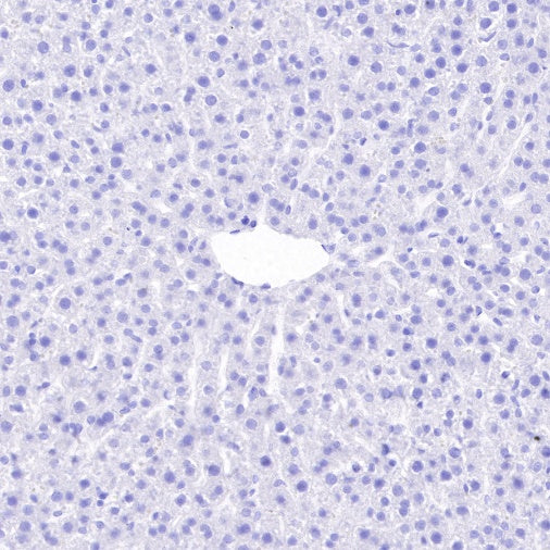 S-RMab® Pan Trk Recombinant Rabbit mAb (SDT-512-5)